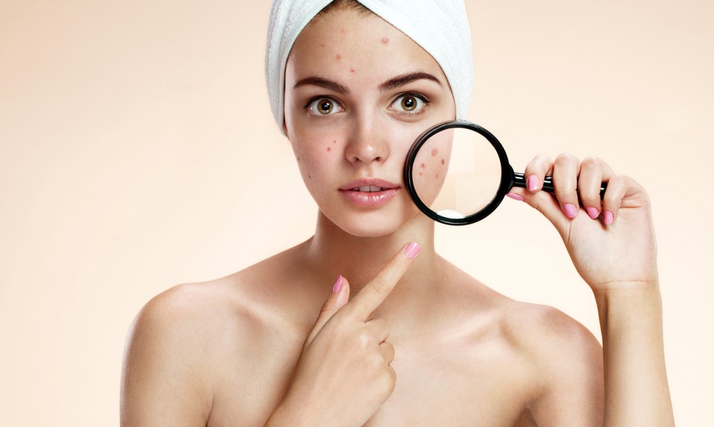 Teen girl with problem skin look at pimple with magnifying glass
